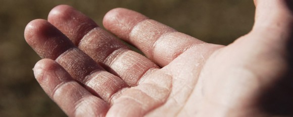 featured_fried_hands featured_fried_hands